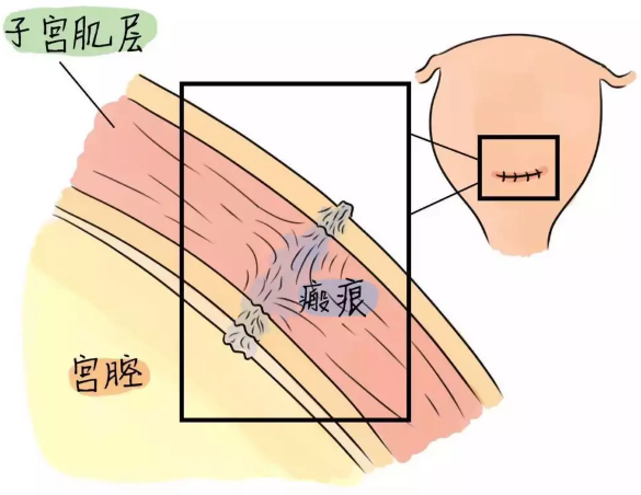重慶送子鳥(niǎo)醫(yī)院