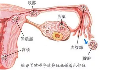 重慶送子鳥醫(yī)院