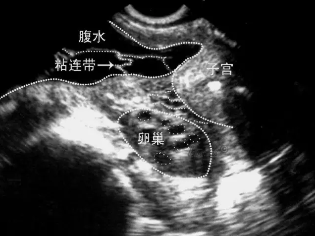 重慶送子鳥(niǎo)醫(yī)院